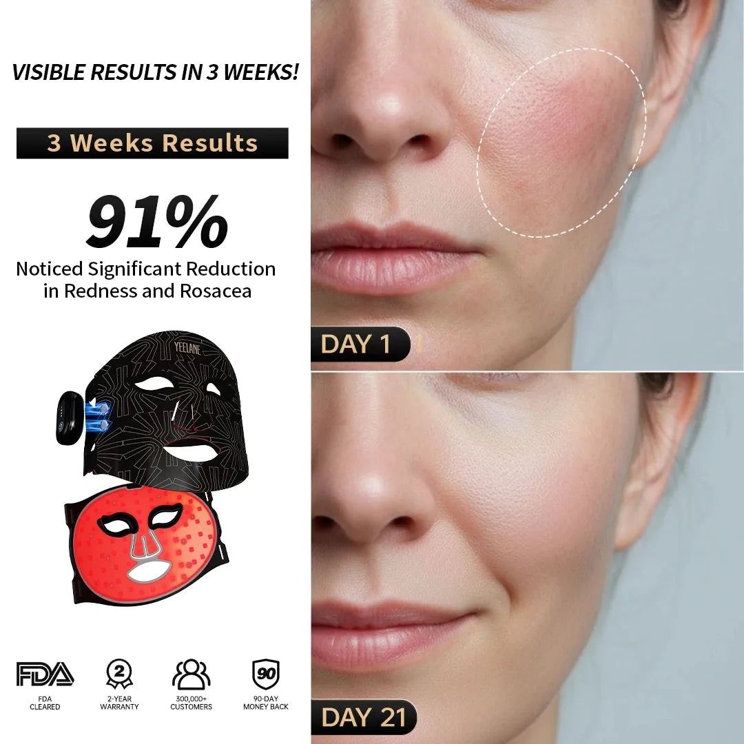  Yeelane AuraGlow Mask Yeelane Massage/Relaxation tmzpua-tt.myshopify.com yeelane-auraglow-mask