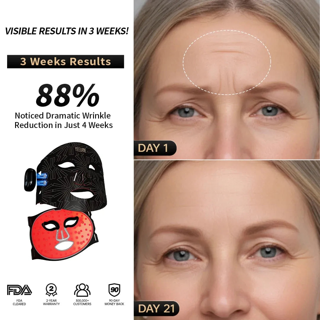  Yeelane AuraGlow Mask Yeelane Massage/Relaxation tmzpua-tt.myshopify.com yeelane-auraglow-mask