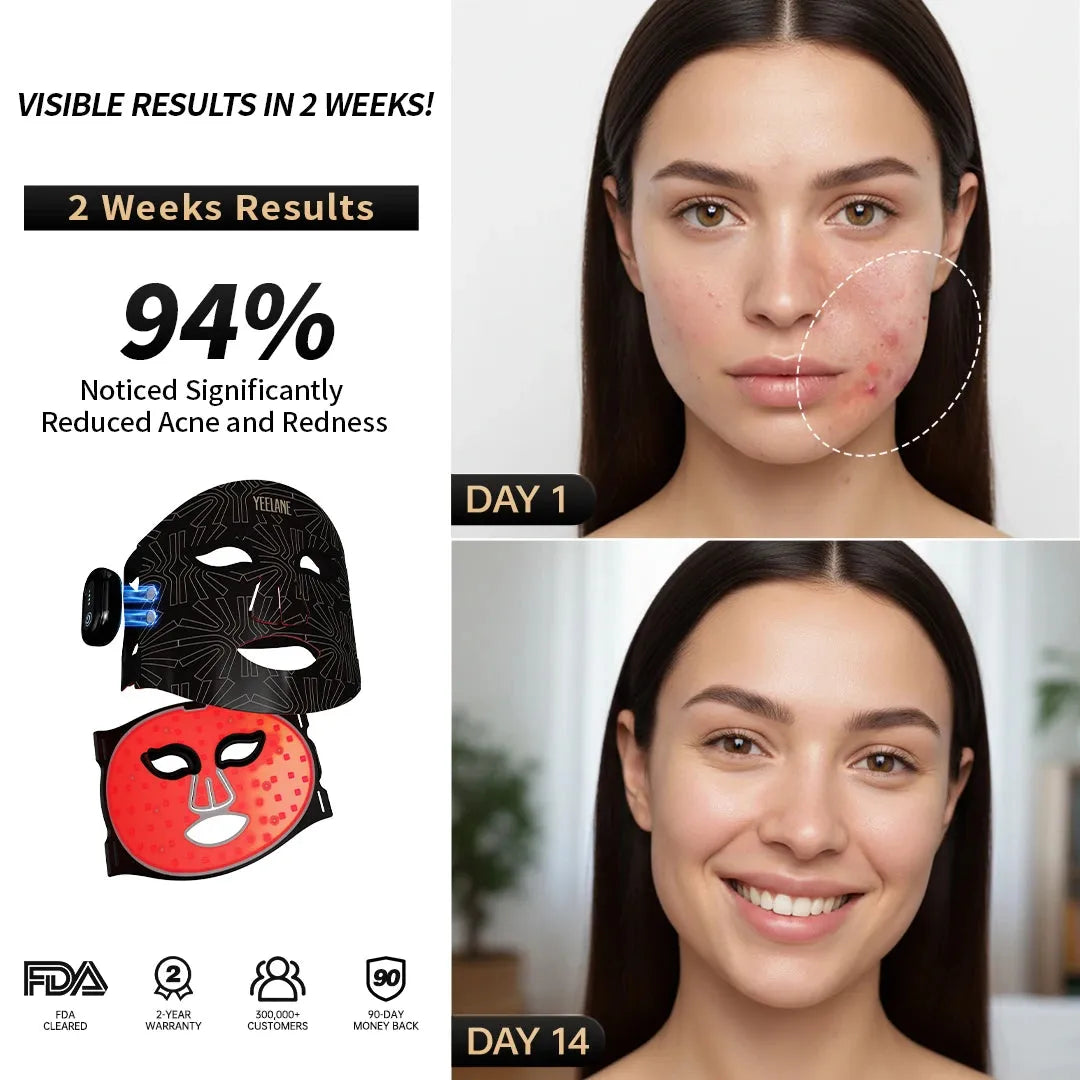  Yeelane AuraGlow Mask Yeelane Massage/Relaxation tmzpua-tt.myshopify.com yeelane-auraglow-mask